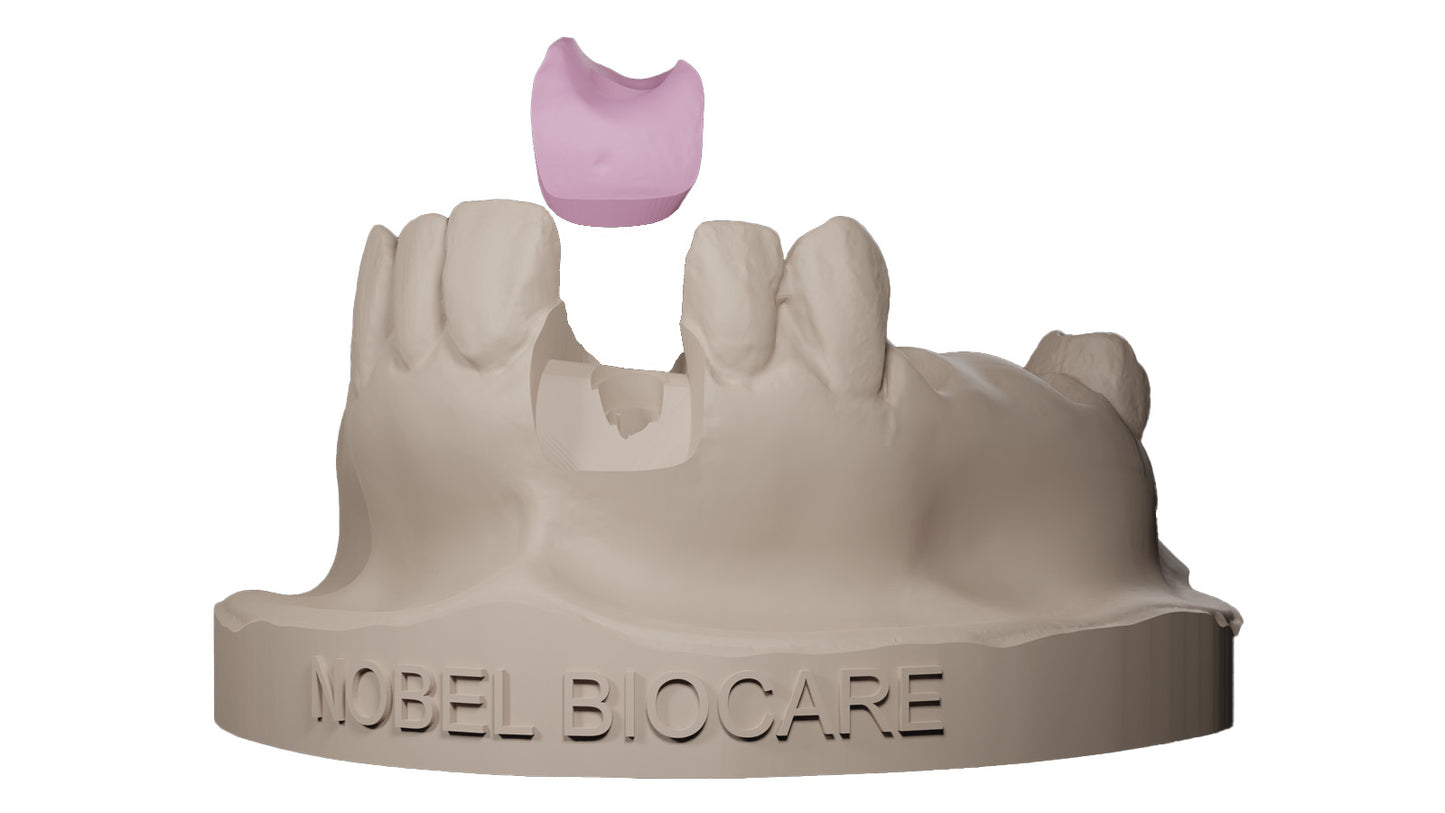 Monocure3D Gingiva Flexible Dental Model Resin